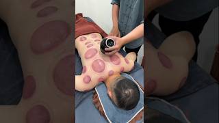 Download lagu Apa Manfaat Bekam untuk Tubuh? mp3 Download lagu Apa Manfaat Bekam untuk Tubuh? mp3