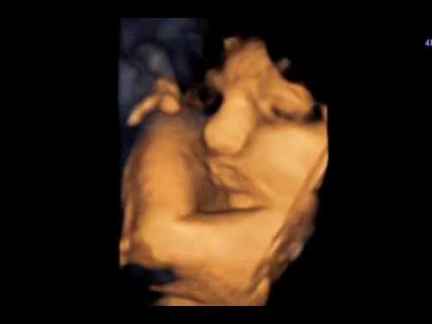 Farmaci vitamine in osteocondrosi della zona lombare Frattura 4 vertebre del rachide cervicale