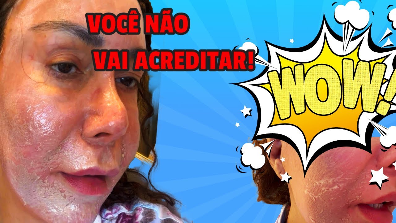 PEELING DO MAR MORTO ANTES E DEPOIS | JOANNA MARIA