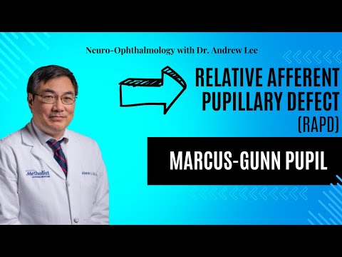 RAPD, Relative Afferent Pupillary Defect, Marcus-Gunn pupil