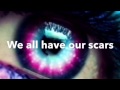 Scars by Allison Iraheta (Lyrics)