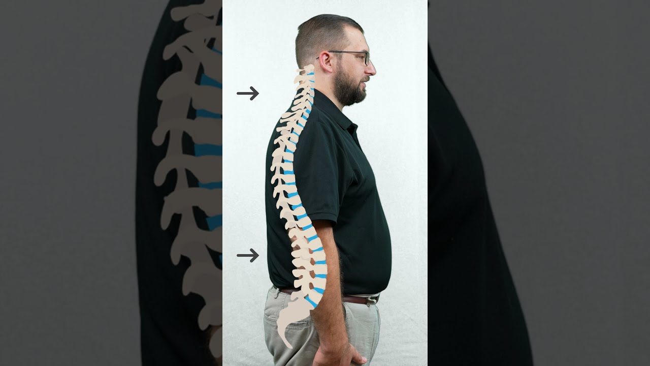 What Is The Natural Shape Of The Spine?