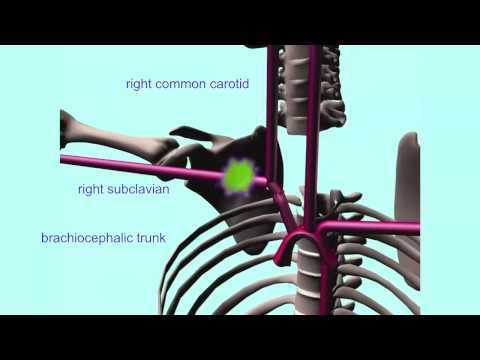 ARTERIES OF THE THORAX