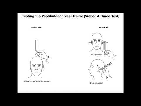 Interpreting the Weber-Rinne Tests EXPLAINED