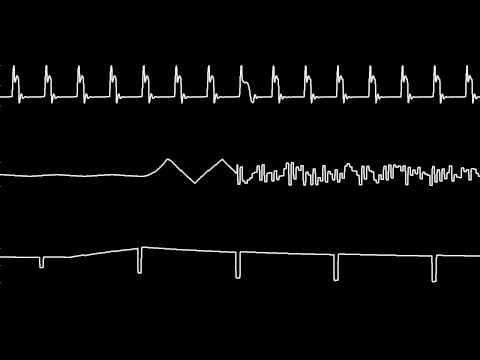 C64 Rob Hubbard's "Lightforce" Oscilloscope view