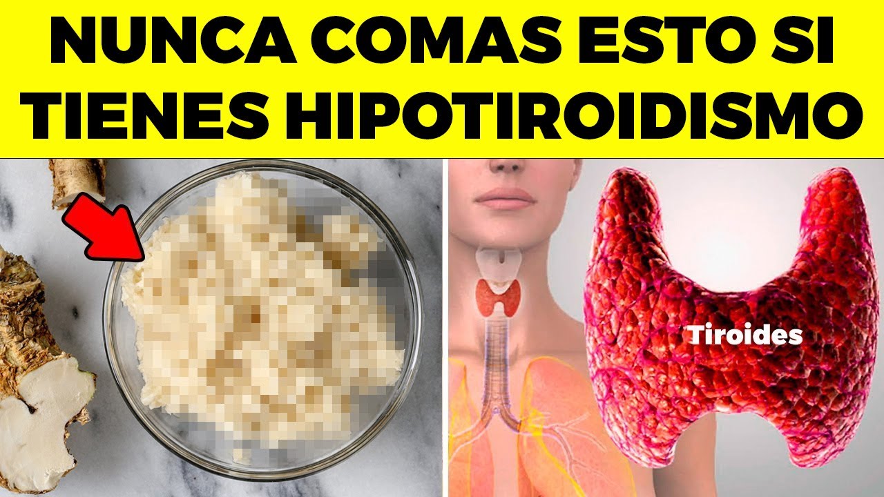 10 ALIMENTOS que NUNCA DEBES COMER si tienes HIPOTIROIDISMO