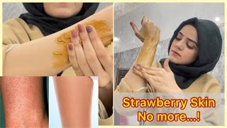 How To Get A Rid Of Strawberry Skin | Smooth Skin After Wax | Dietitian Aqsa
