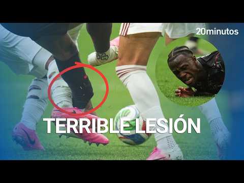MUNDIAL 2026: la ESCALOFRIANTE lesión de KONÉ
