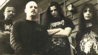 Dying Fetus - Lethal Injection (Incredibly rare)