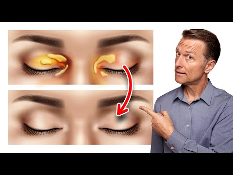 Shingles Natural Relief