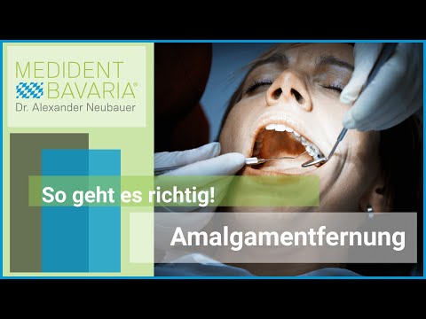 Die sichere und saubere Amalgamentfernung - so geht es richtig!