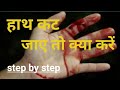 What to do if hand is cut || what to do if hand got cut / injured