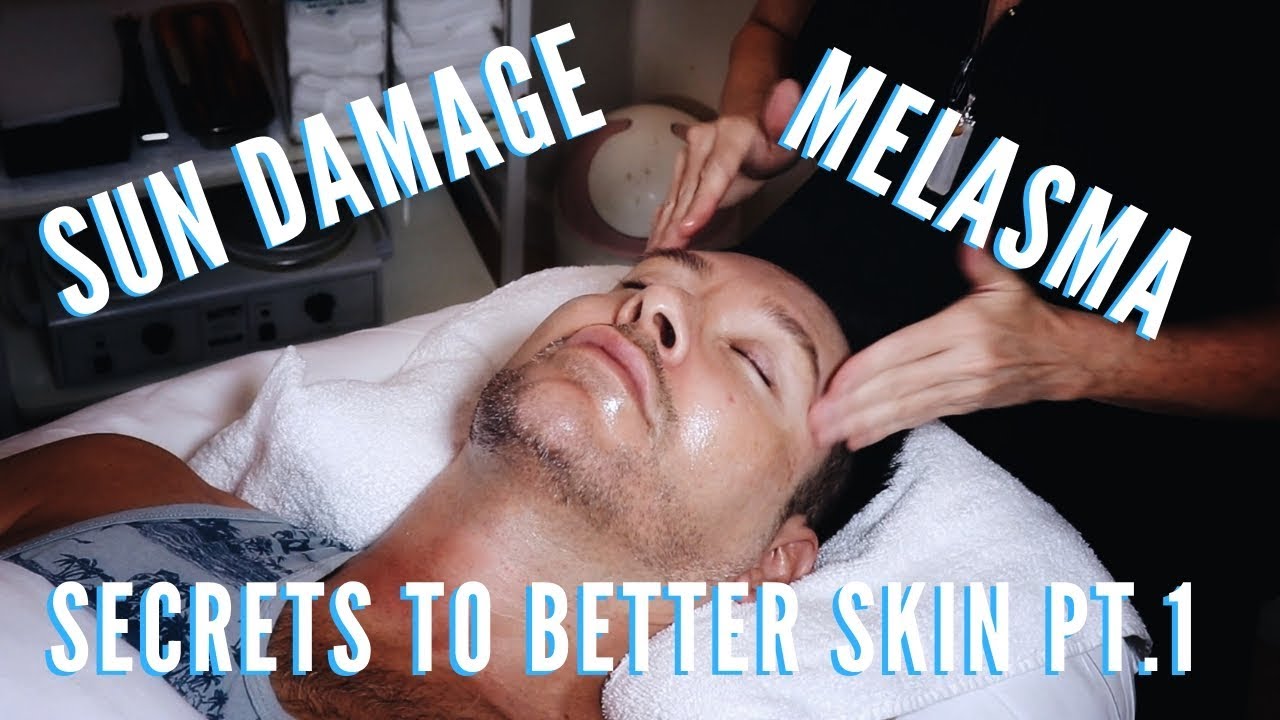 Hyperpigmentation Causes, Symptoms, Types, And Treatments | Skincare Series Ep. 1 | mathias4makeup