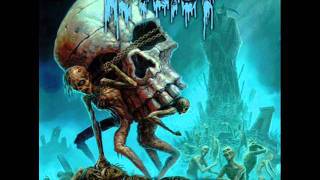 Autopsy Charred Remains