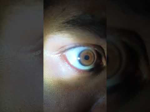pupils dilation when bright light enters eyes... .....#science #eyes #pupils #beautiful #browneyes