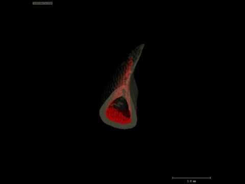 Tracking of Bone Loss Through Serial µ-CT Image Registration, 1408 view 1