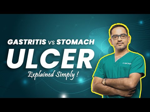 Gastritis vs Stomach Ulcer | Dr. Deepak Subramanian