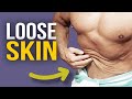 Will I Have LOOSE SKIN After WEIGHT LOSS?