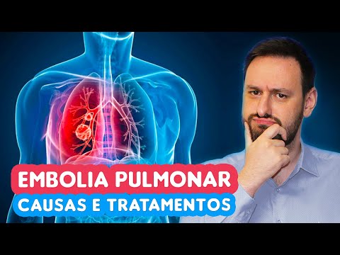 Você sabe o que é EMBOLIA PULMONAR? Tem tratamento?