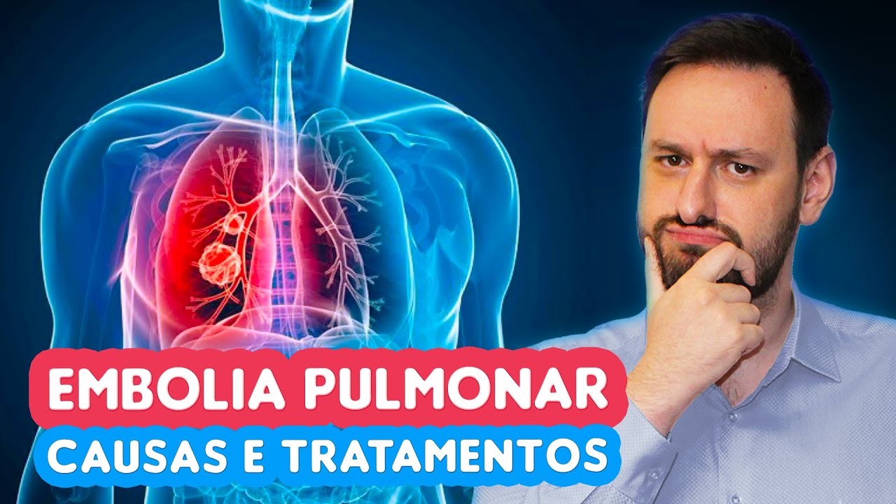 Você sabe o que é EMBOLIA PULMONAR? Tem tratamento?