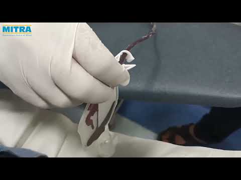 Triple blood bag Triple blood collection bags