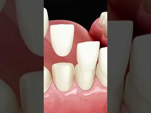 video AHhfg0JUmOU