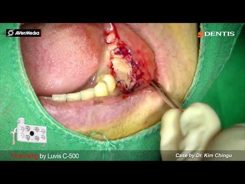 download lagu mp3 mp4 Luvis, download lagu Luvis gratis, unduh video klip Luvis