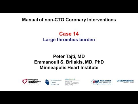 Case 14: PCI Manual: Large coronary thrombus