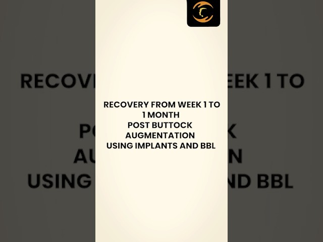 Buttock Implants Journey