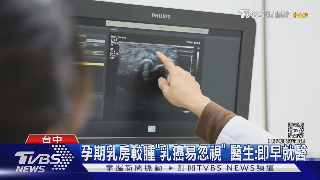 懷孕期間確診乳癌!媽媽抗癌 寶寶順利出生