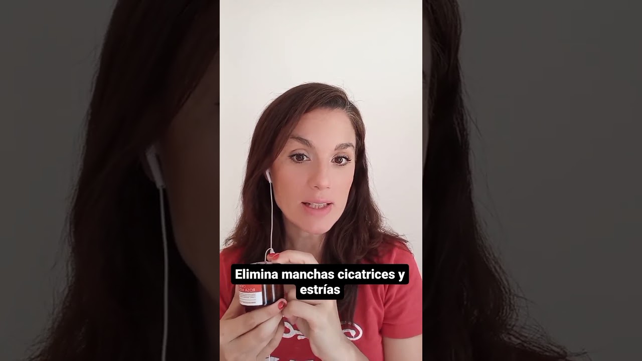 Elimina manchas cicatrices y estrías con nuestra crema de rosa Mosqueta