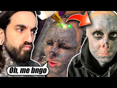 Se BORRA la CARA con LASER tras ARREPENTIRSE de su TRANSFORMACIÓN 🤯