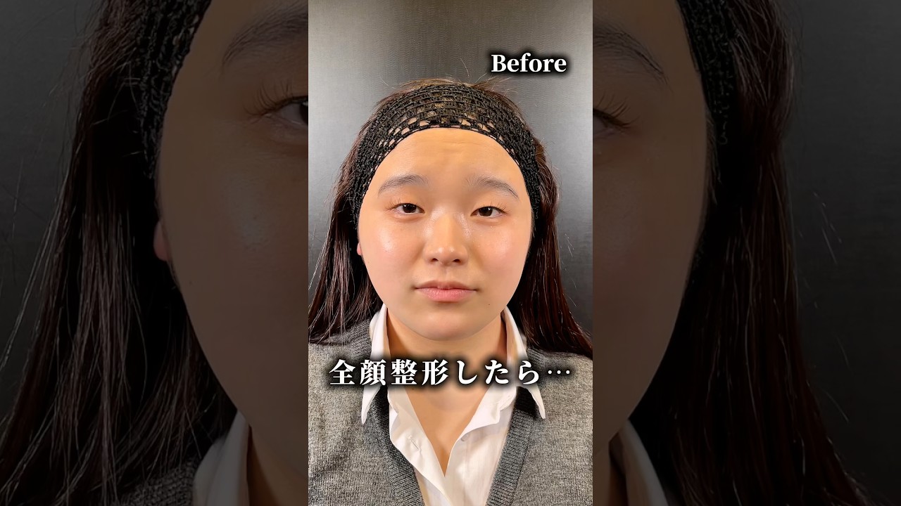 【全顔整形】#shorts どう変わる？