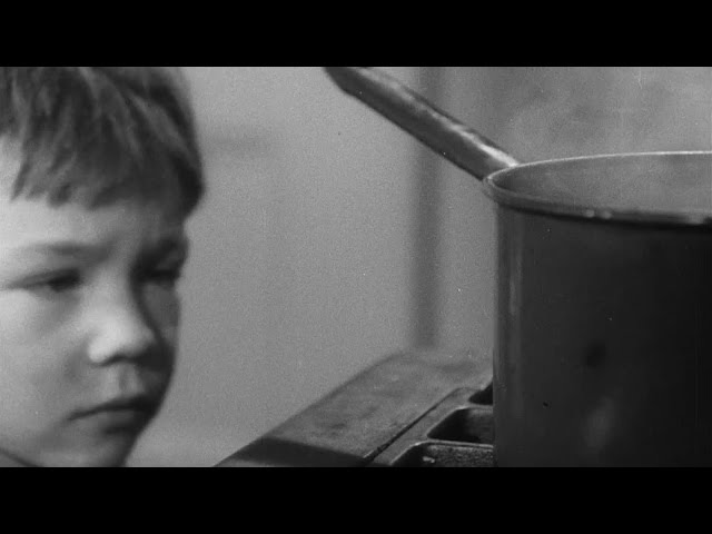Burns and Scalds (1947)