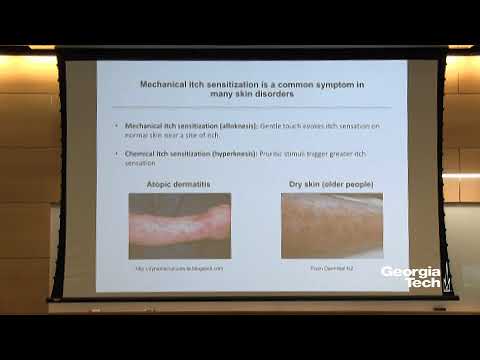 Genetic Dissection of Spinal Circuits Processing Mechanical Itch