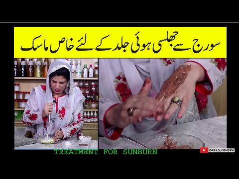 Best Home Remedy for Sun Tanning | Sun Burn Treatment by Dr. Bilquis Shaikh