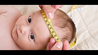 EVALUACION DEL PERIMETRO CEFALICO