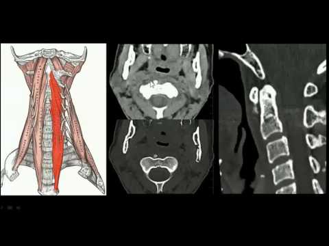 Se è possibile massaggiare la colonna vertebrale cervicale Stiramento ginocchio della gamba