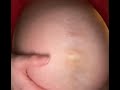 Rubbing Cream On My Belly Past Pregnancy