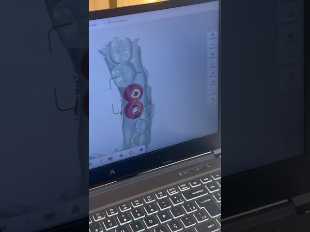 Vídeo