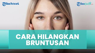 Cara Cepat Menghilangkan Bruntusan pada Kulit Wajah, Kenali Penyebabnya