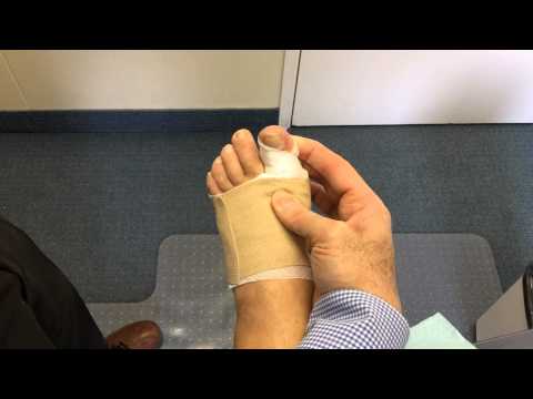 Exercises for Big Toe Following Bunion Surgery