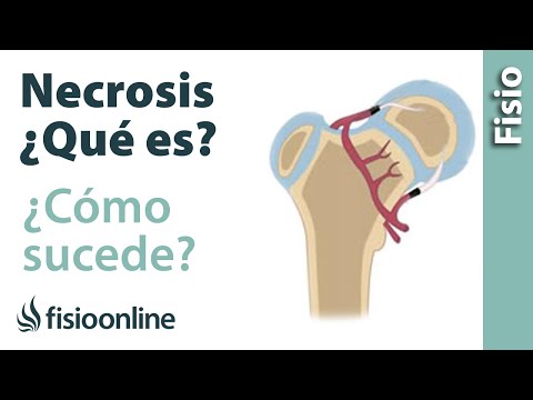 Un conjunto de ejercicios escoliosis torácica columna vertebral Cuando los músculos y las articulaciones doloridas que la forma de tratar