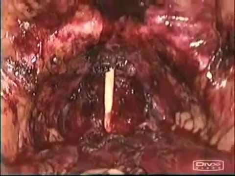 Massaggio prostatico erotico video online gratis Supplementi nutrizionali per la prostata