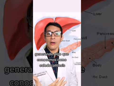 Risks of having gallstones