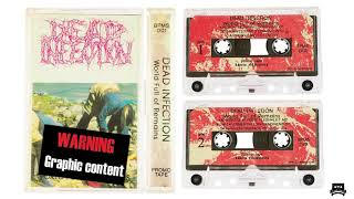 DEAD INFECTION (PL) - WORLD FULL OF REMAINS (FULL DEMO)