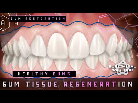 Full Gum Tissue Regeneration - Energetically Programmed Audio - Sub Warlock