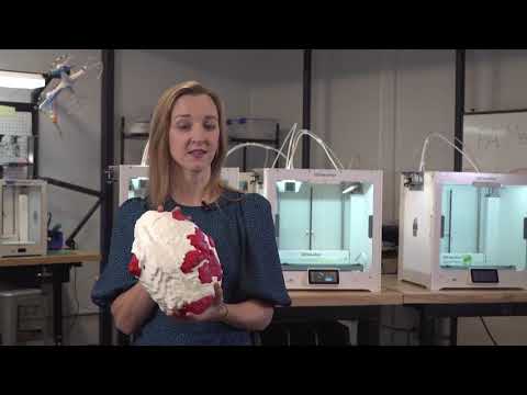 3-D print in surgery