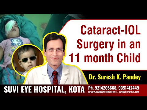 Phaco aspiration and IOL Implantation in a Child