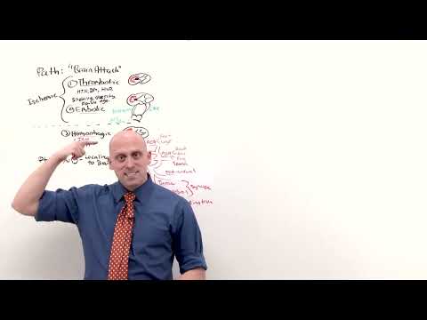 1. Stroke | Neurology